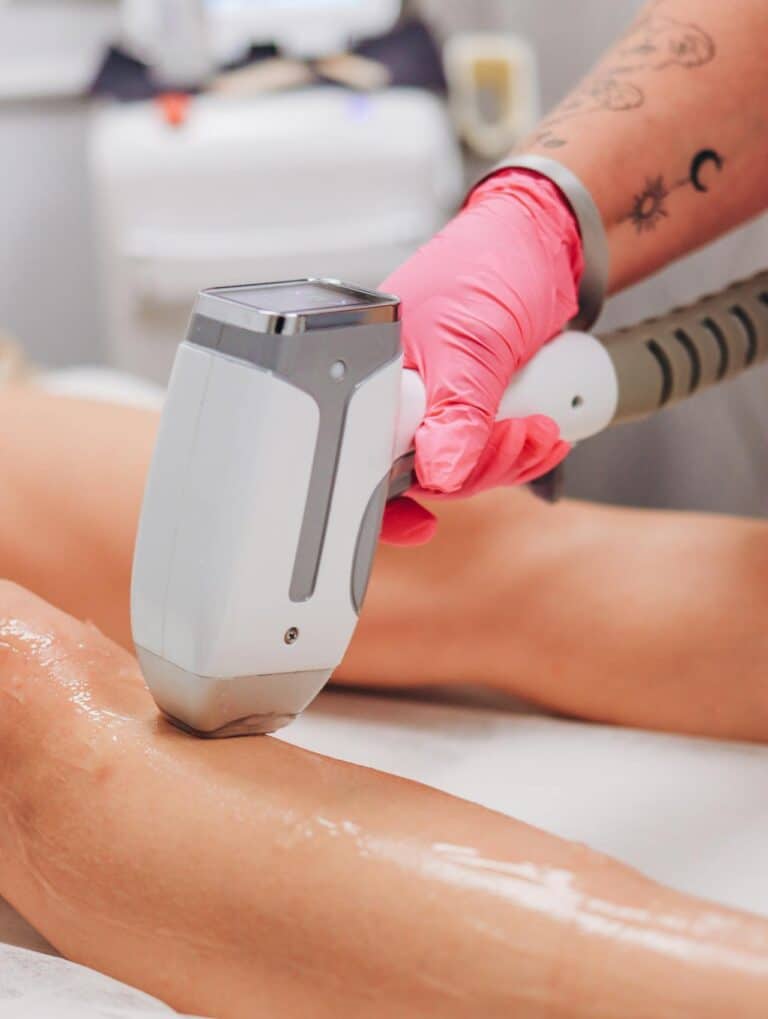 Permanent hårfjerning med laser